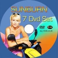 site-sunburn Sunburn
